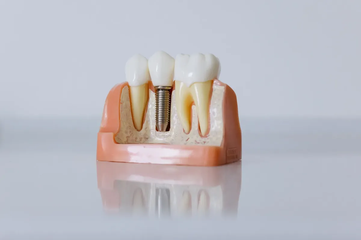Detailed dental implant model showcasing teeth structure for educational purposes.
